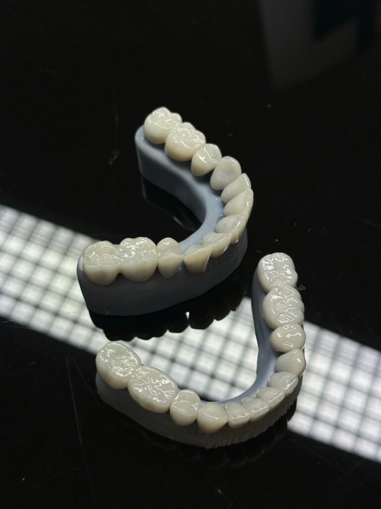 Detailed view of dental veneers placed on a dark reflective surface, showcasing dental craftsmanship.